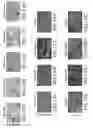 Fig. 30 - Generation of human induced pluripotent stem cells using nucleic acid sequences that inhibit Δ-NP63 and DGCR8