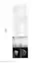Fig. 02 - Method for preparing decellularized tissue product, and graft provided with decellularized tissue product
