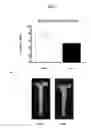 Fig. 02 - Methods for treatment of atherosclerosis