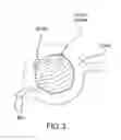 Fig. 04 - Method and composition for hyperthermally treating cells