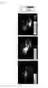 Fig. 03 - Compound and photoacoustic imaging contrast medium containing the compound