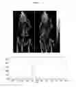 Fig. 06 - Compounds with reduced ring size for use in diagnosing and treating melanoma, including metastatic melanoma and methods related to same