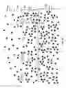 Fig. 09 - Methods of drying sheets of donor-provided human birth tissue