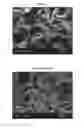 Fig. 01 - Method for bone formation by administering poly(lactic-co-glycolic acid) cross-linked alendronate