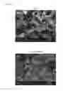 Fig. 02 - Method for bone formation by administering poly(lactic-co-glycolic acid) cross-linked alendronate