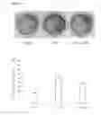 Fig. 07 - Method for bone formation by administering poly(lactic-co-glycolic acid) cross-linked alendronate