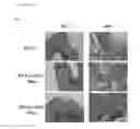 Fig. 19 - Method for bone formation by administering poly(lactic-co-glycolic acid) cross-linked alendronate