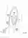 Fig. 05 - Embolization
