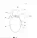 Fig. 15 - Irrigation and aspiration device and method