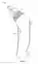 Fig. 19 - Irrigation and aspiration device and method