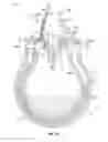 Fig. 24 - Irrigation and aspiration device and method