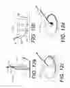 Fig. 14 - Externally-applied patient interface system and method with a controlled region for implanted or buried bio-reactor