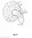 Fig. 09 - HANDS-FREE BREAST PUMP SYSTEM