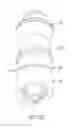 Fig. 05 - NEEDLELESS CONNECTOR MODULE