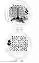 Fig. 08 - Cortical implant system for brain stimulation and recording