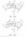Fig. 20 - Cortical implant system for brain stimulation and recording