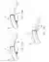 Fig. 24 - Cortical implant system for brain stimulation and recording