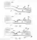 Fig. 28 - Cortical implant system for brain stimulation and recording