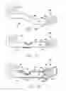 Fig. 30 - Cortical implant system for brain stimulation and recording