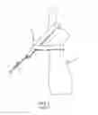 Fig. 02 - Convertible arm cord loop handle