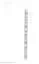 Fig. 07 - Grommet strip