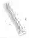 Fig. 10 - Playground slide
