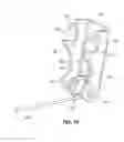 Fig. 09 - Stored energy stapler