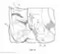 Fig. 06 - Textile cover for streamlining wide based truck or bus wheels