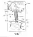 Fig. 13 - Textile cover for streamlining wide based truck or bus wheels