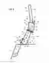 Fig. 04 - Seatback bar structure of vehicle