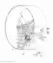 Fig. 05 - Systems and apparatus for tether termination mount for tethered aerial vehicles