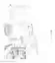 Fig. 20 - Cable drum transportation and handling apparatus