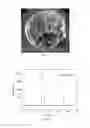 Fig. 03 - Ultrahard nanotwinned boron nitride bulk materials and synthetic method thereof