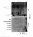Fig. 07 - TRANSGENIC PLANTS EXPRESSING COBALAMIN BINDING PROTEINS