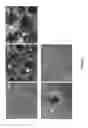 Fig. 03 - METHOD OF IN VITRO DIFFERENTIATION OF MOTOR NEURON PROGENITORS (MNPS) FROM HUMAN INDUCED PLURIPOTENT STEM CELLS AND CRYOPRESERVATION OF MNPS