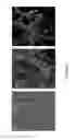 Fig. 05 - METHOD OF IN VITRO DIFFERENTIATION OF MOTOR NEURON PROGENITORS (MNPS) FROM HUMAN INDUCED PLURIPOTENT STEM CELLS AND CRYOPRESERVATION OF MNPS