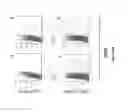 Fig. 13 - Methods for inducing migration by dendritic cells and an immune response