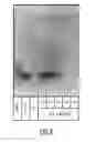 Fig. 09 - Method for transfection of nucleic acids into eukaryotic cells in 3D scaffold