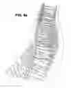 Fig. 06 - Retaining wall