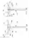 Fig. 08 - UTILITY OR METER POLE TOP REINFORCEMENT METHOD AND APPARATUS