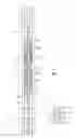 Fig. 02 - Downhole fishing tool and method of use