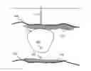 Fig. 01 - Oil recovery with insulating composition