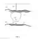 Fig. 02 - Oil recovery with insulating composition
