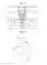 Fig. 03 - BLOWBY GAS VENTILATION SYSTEM FOR SUPERCHARGER-EQUIPPED INTERNAL COMBUSTION ENGINE