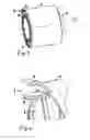 Fig. 03 - Filter device, in particular for gas filtration