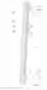 Fig. 05 - Wind turbine tower suspension means