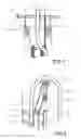 Fig. 03 - Hose guiding device