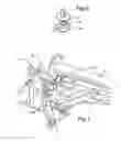 Fig. 04 - Portable modular monopole tower foundation