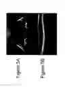 Fig. 07 - Image registration, averaging, and compounding for high speed extended depth optical coherence tomography