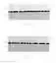 Fig. 09 - Semiconductor sensor having a suspended structure and method of forming a semiconductor sensor having a suspended structure